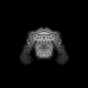 X projection