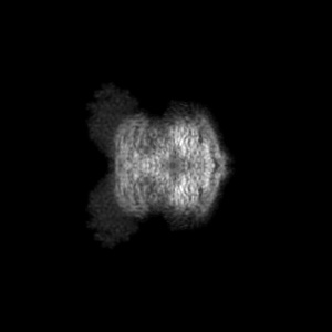 Y projection