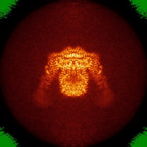 X projection