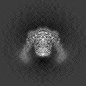 X projection