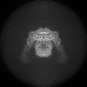X projection