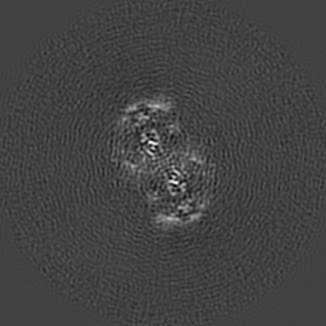 Z projection