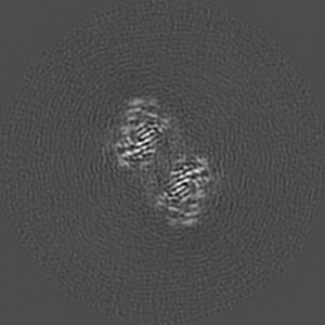 Z projection