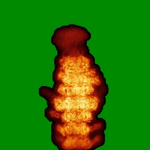 X projection