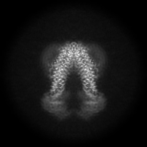 X projection