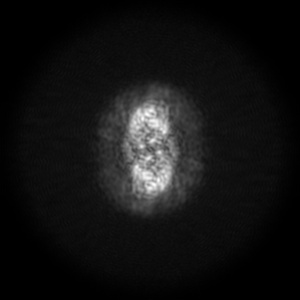 Z projection