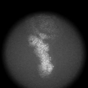 X projection