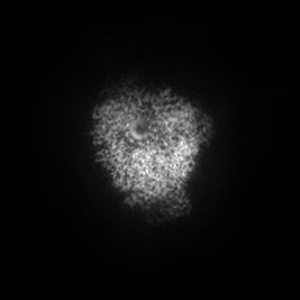 X projection