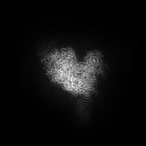 Y projection