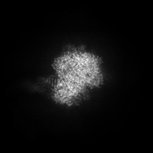 Z projection