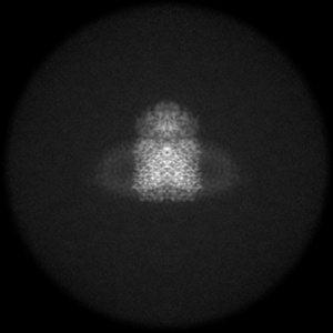 X projection