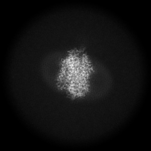 X projection