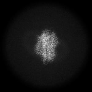 X projection