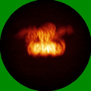 X projection