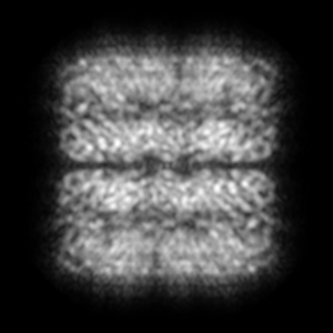 X projection