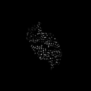 X projection