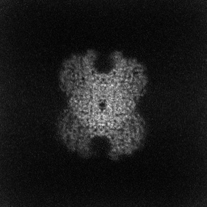 X projection