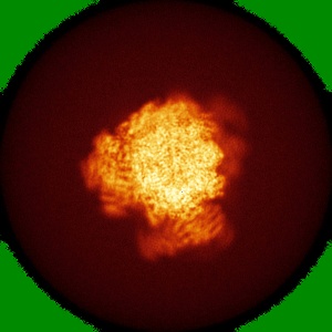 X projection