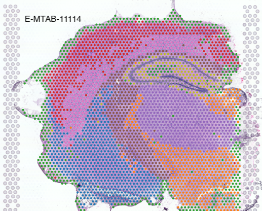 Sequencing-based spatial transcriptomics example.
